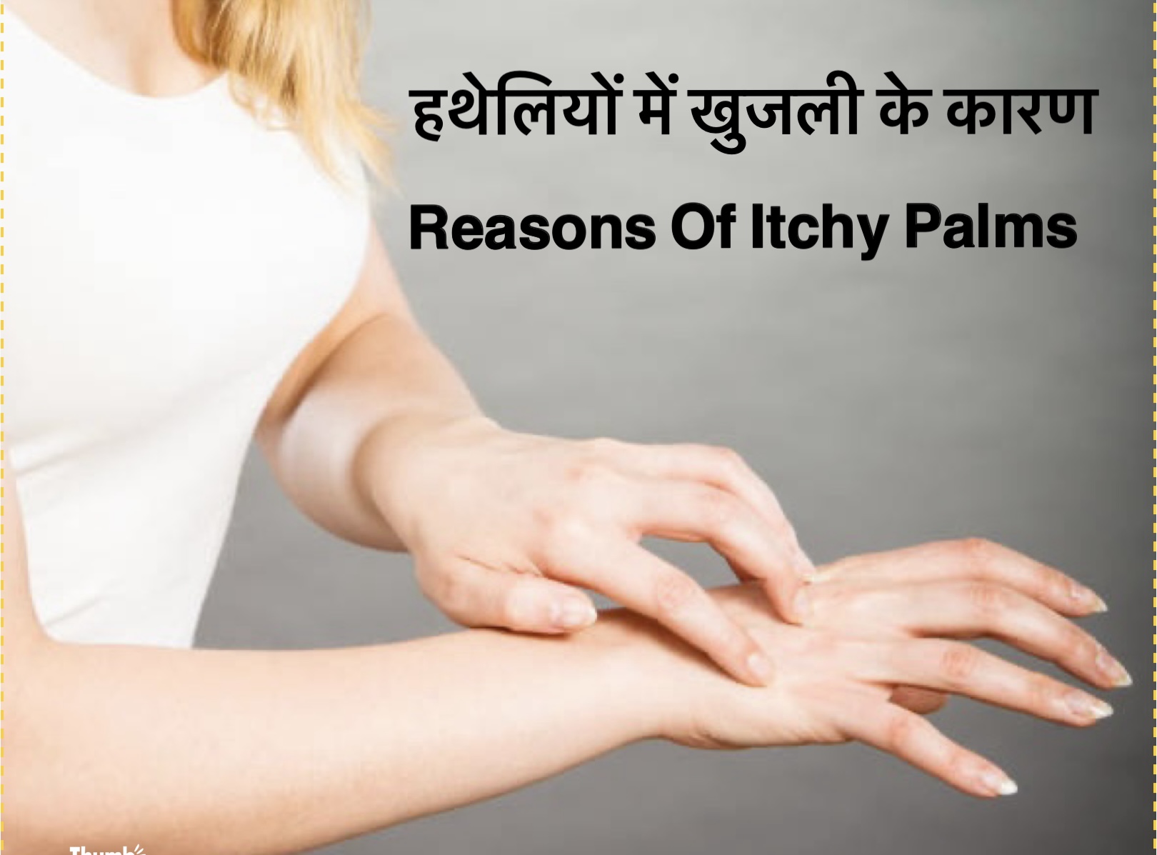 Itchy palms reason